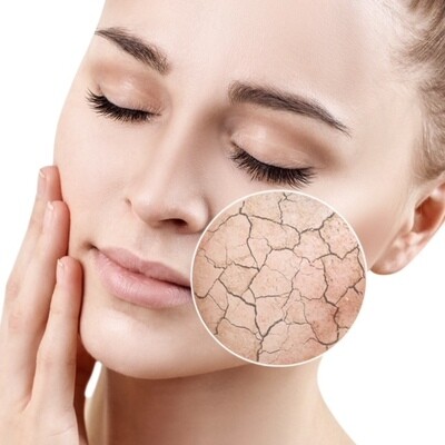 Dehydrated &amp; Dry Skins