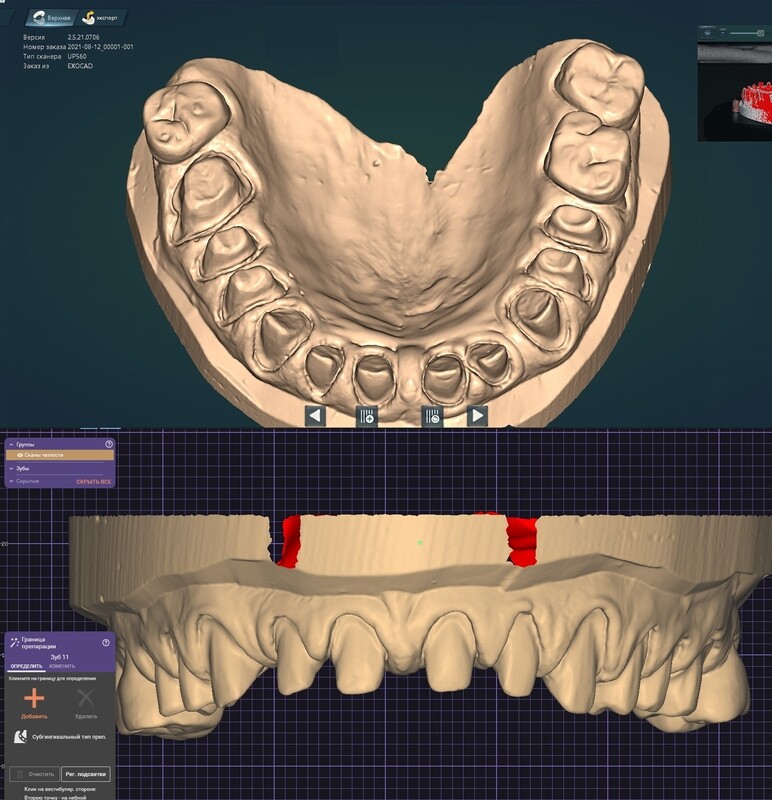 3D Scanner UP400 Labor (10 micron)