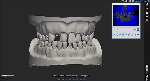 3D Scanner Optic DOF Swing HD 2.0mpx Labor