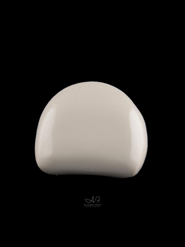 Bioflx - Anterior Crowns