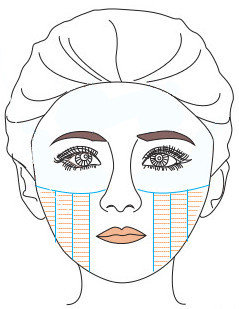 Soin HiFu 450€ : ovale du visage ( lifting )