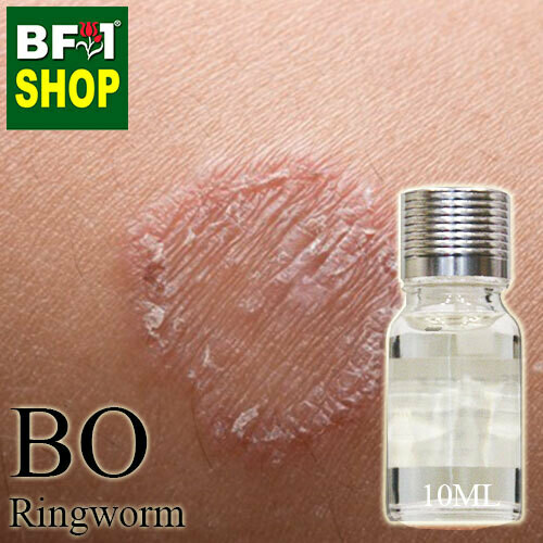 Blended Essential Oil (BO) - Ringworm Essential Oil - 10ml