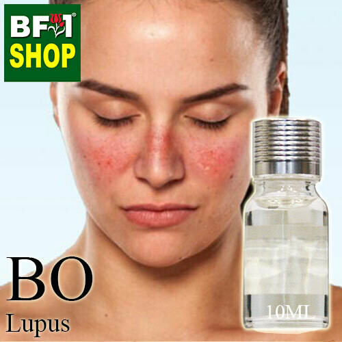 Blended Essential Oil (BO) - Lupus Essential Oil - 10ml