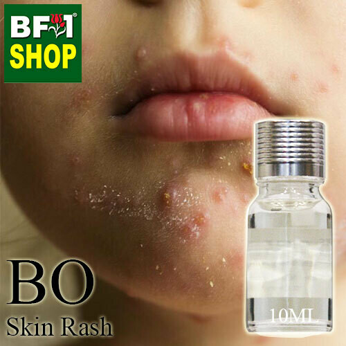 Blended Essential Oil (BO) - Skin Rash Essential Oil - 10ml