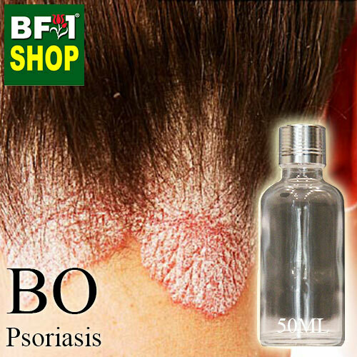 Blended Essential Oil (BO) - Psoriasis Essential Oil - 50ml