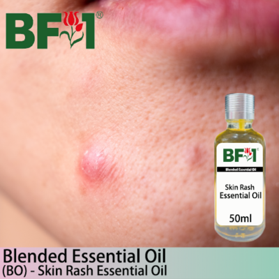 Blended Essential Oil (BO) - Skin Rash Essential Oil - 50ml