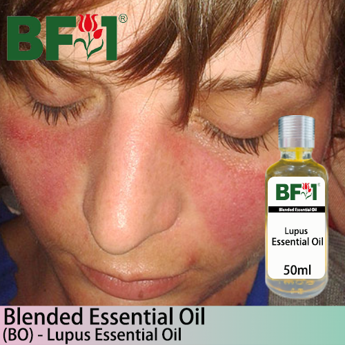 Blended Essential Oil (BO) - Lupus Essential Oil - 50ml