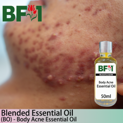 Blended Essential Oil (BO) - Body Acne Essential Oil -50ml