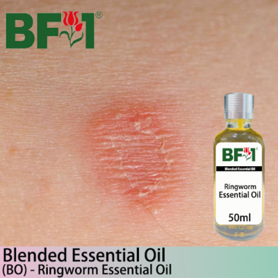 Blended Essential Oil (BO) - Ringworm Essential Oil - 50ml