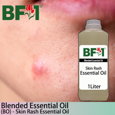 Blended Essential Oil (BO) - Skin Rash Essential Oil - 1L