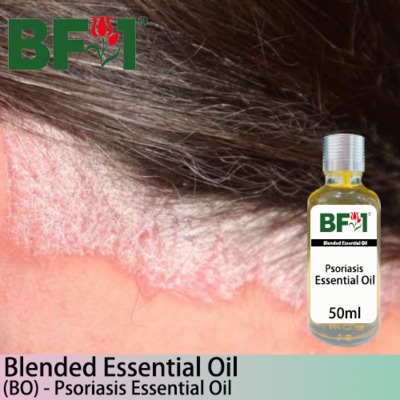 Blended Essential Oil (BO) - Psoriasis Essential Oil - 50ml