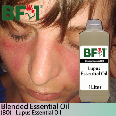 Blended Essential Oil (BO) - Lupus Essential Oil - 1L