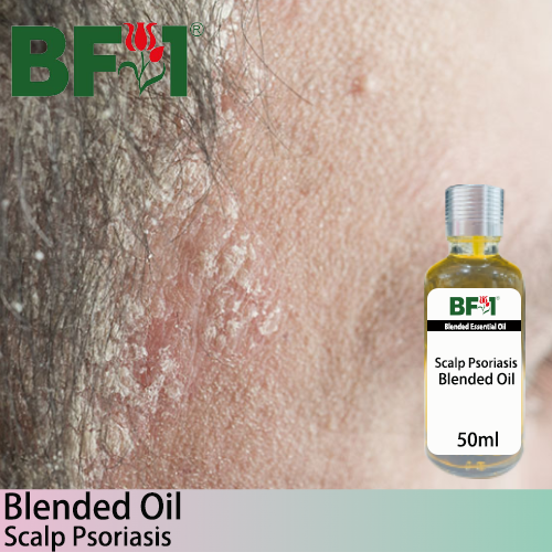 Blended Essential Oil (BO) - Scalp Psoriasis Essential Oil - 50ml