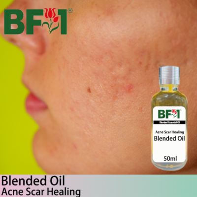 Blended Essential Oil (BO) - Acne Scar Healing Essential Oil -50ml