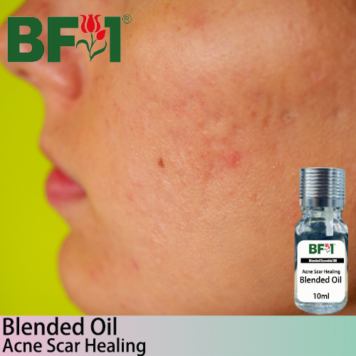 Blended Essential Oil (BO) - Acne Scar Healing Essential Oil -10ml