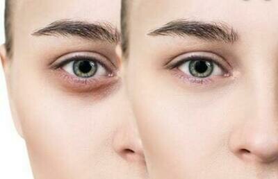 PUFFINESS, DARK CIRCLES