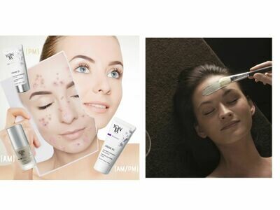 Acne Treatment Gift Package Acne Treatment Gift Package