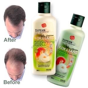 kok liang shampoo : anti-hairloss &amp; smoothnes