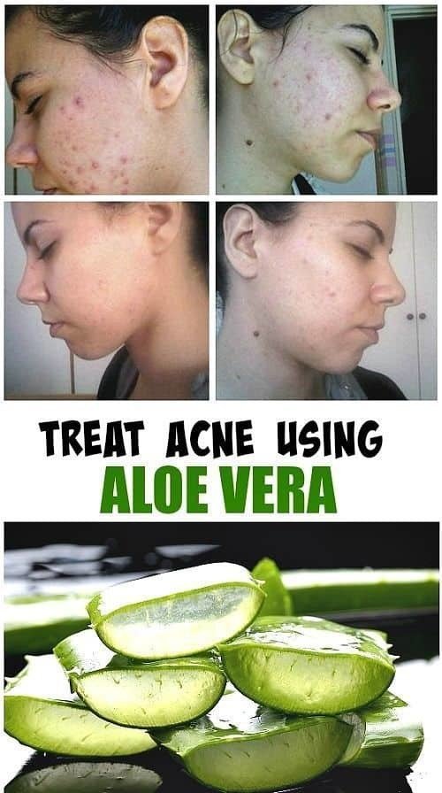 Aloe Vera Pure Gel