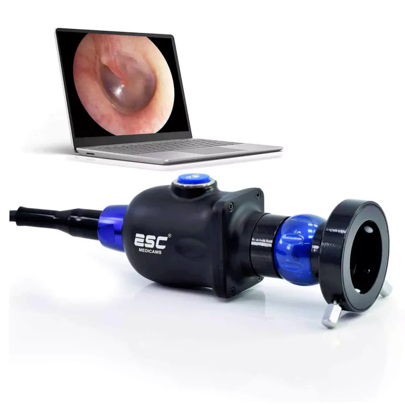 Portable USB ENT Endoscopy Camera