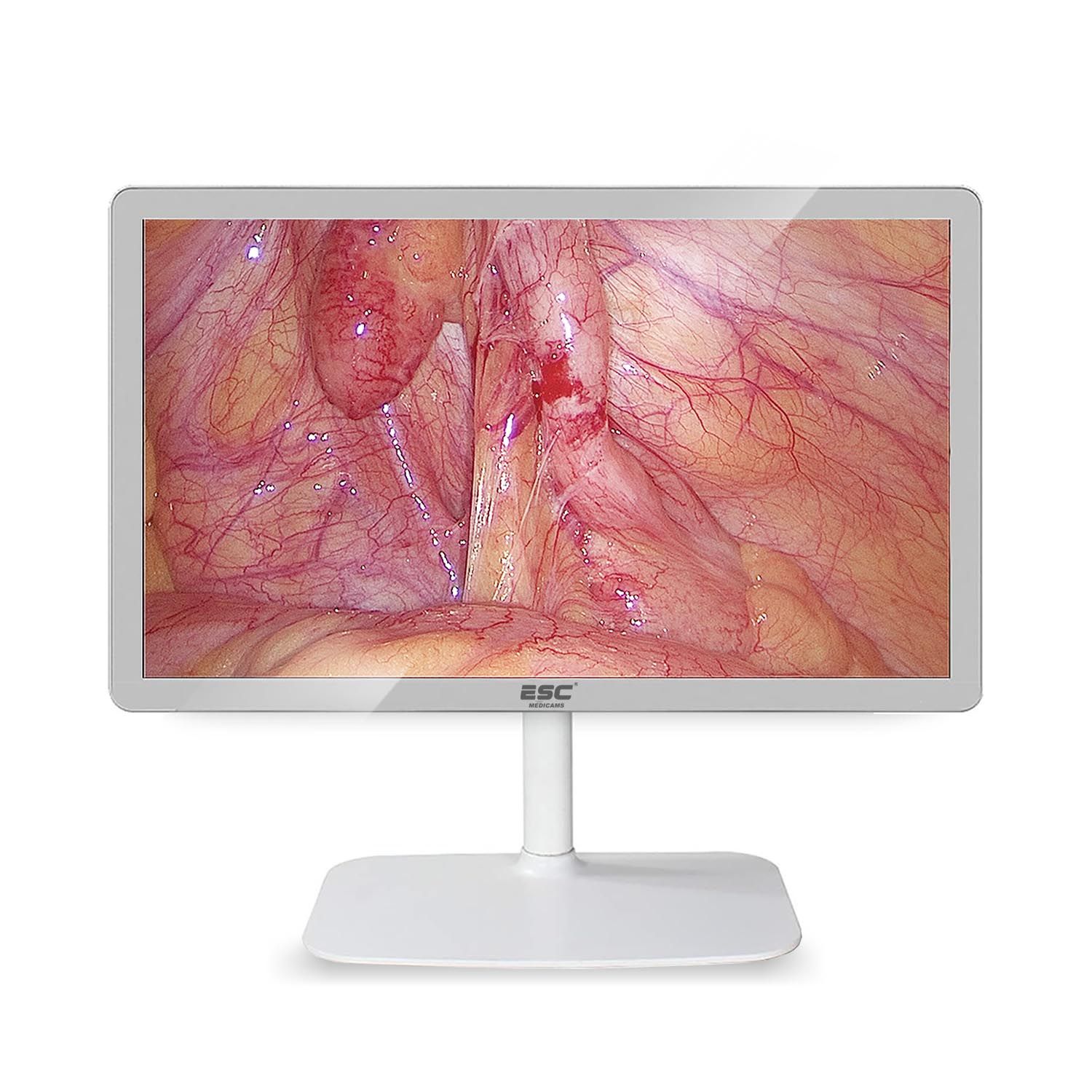 Medical surgical monitor display