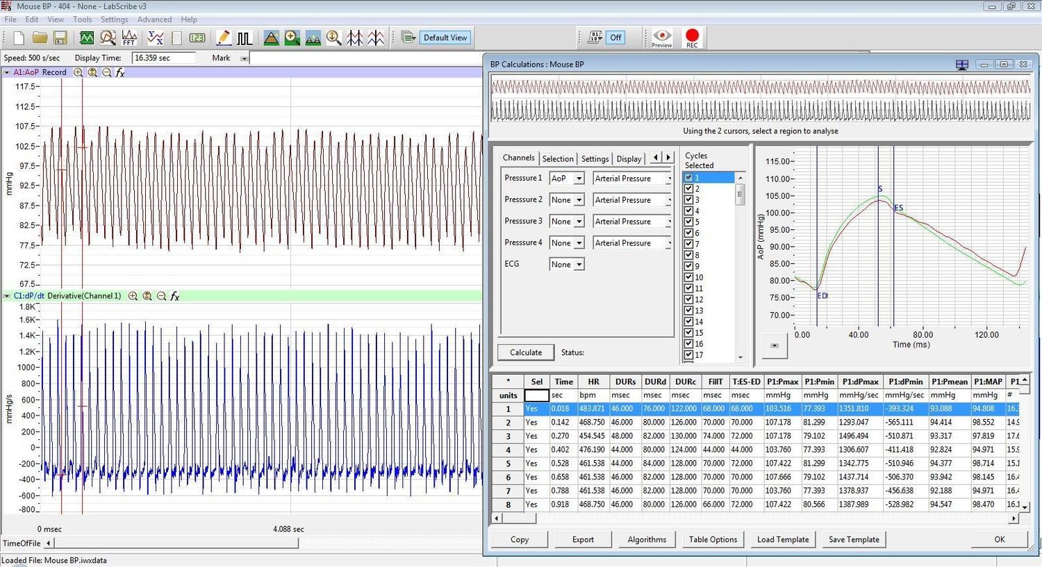 Blood Pressure Analysis Module for LabScribe Software