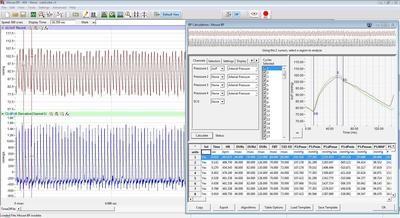 Blood Pressure Analysis Module for LabScribe Software