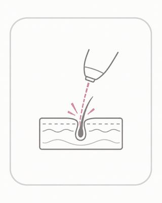 Épilation