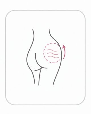 Cellulite