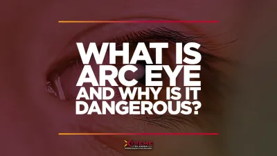 featured image for what is arc eye and why is it dangerous, with someone with arc eye in the background.