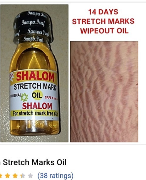 Shalom stretch mark wipe out for both men and womans