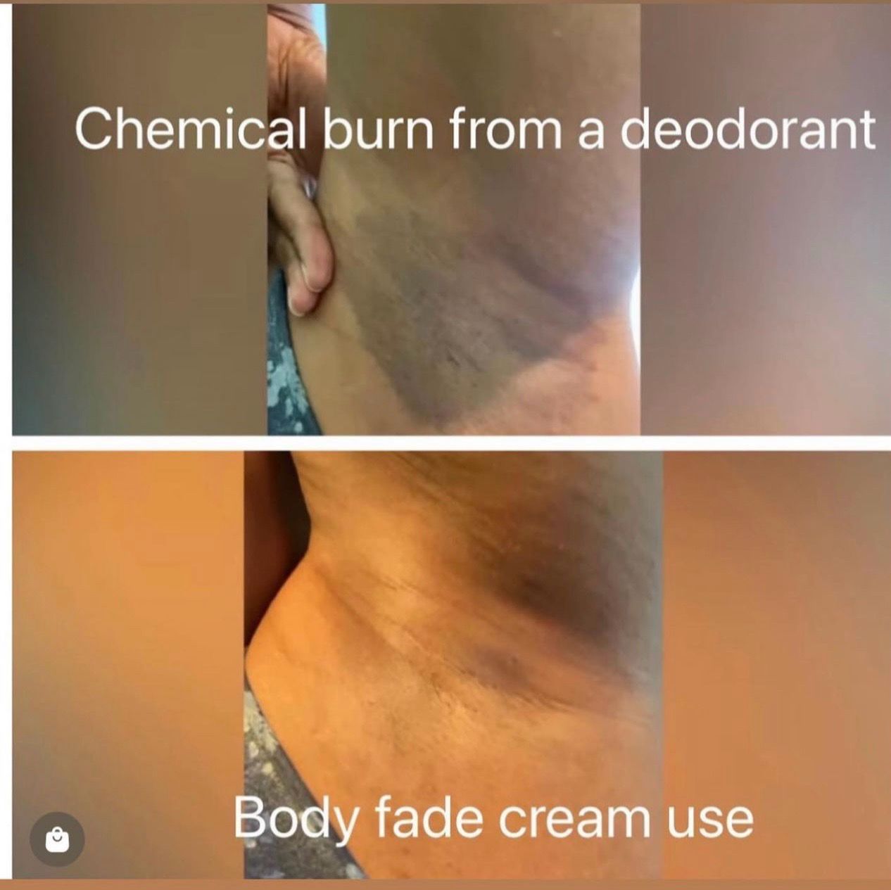 Corrector Skin Cream