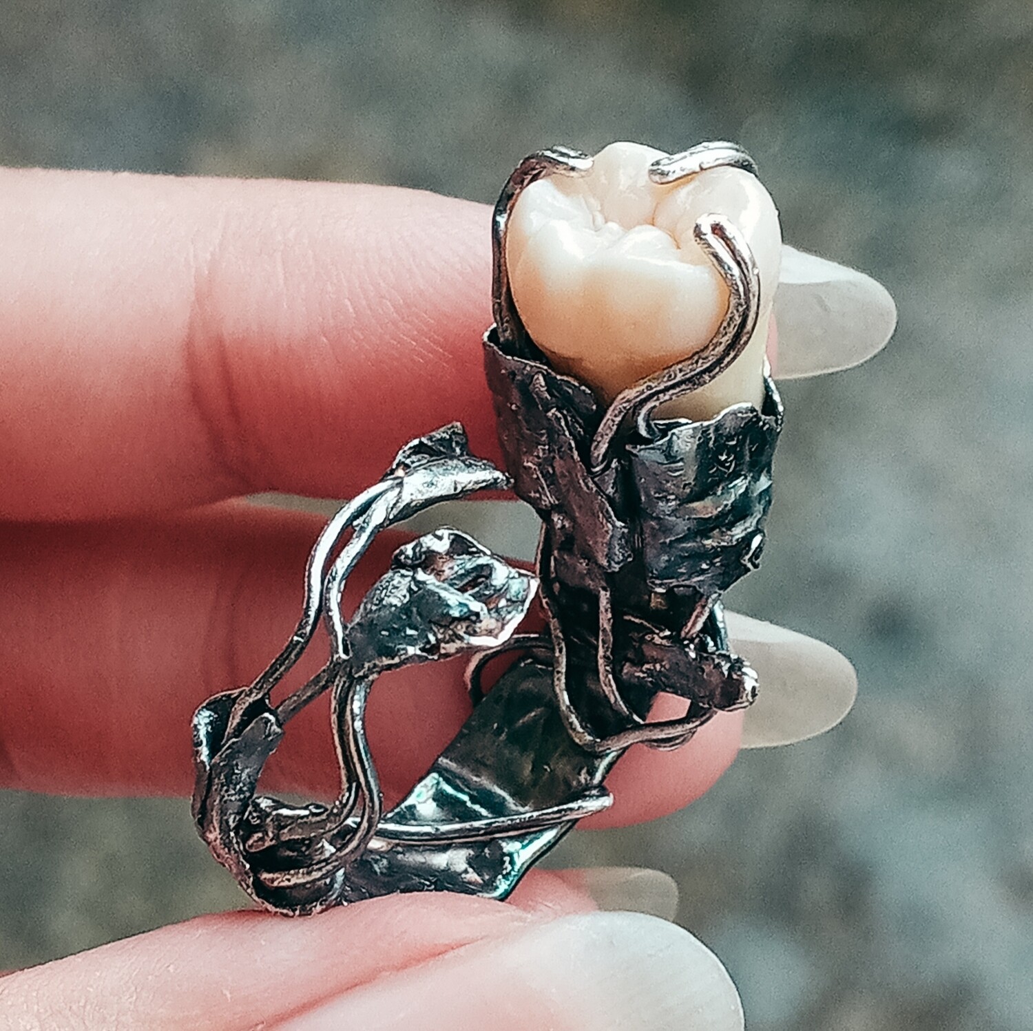 Wisdom Tooth