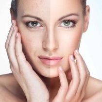 UltraPure Real Peel AHA 8% 50 ml