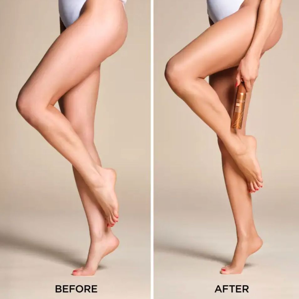SPRAY ON LEG FOUNDATION