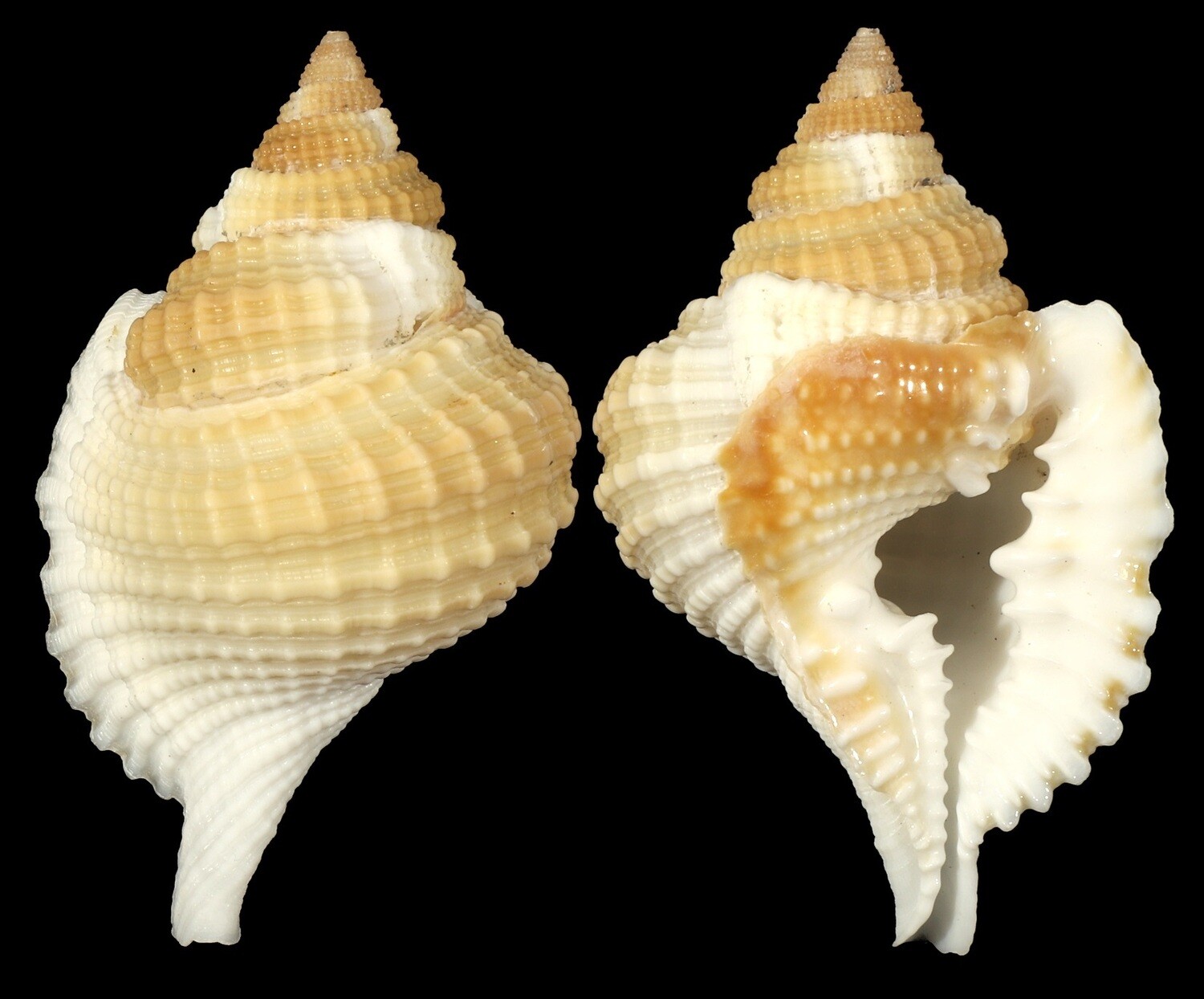 Distorsio reticularis