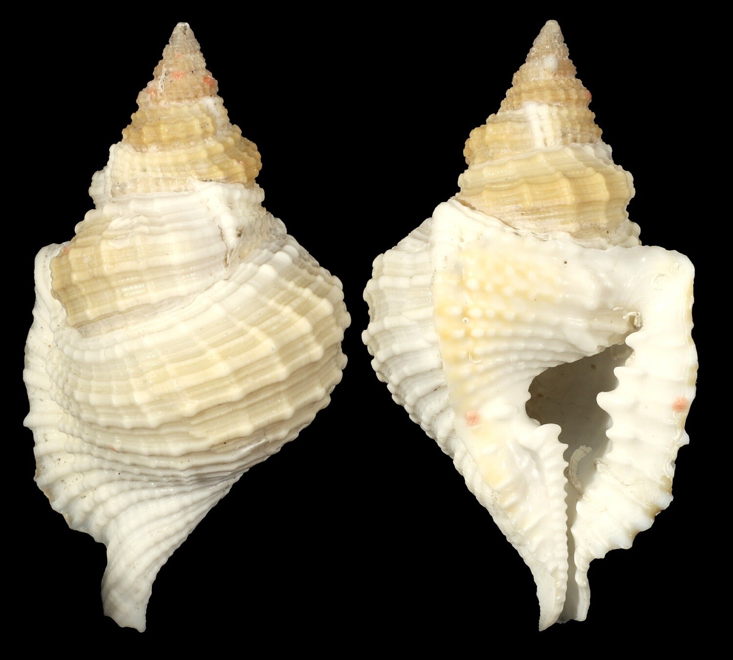 Distorsio reticularis