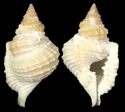 Distorsio reticularis