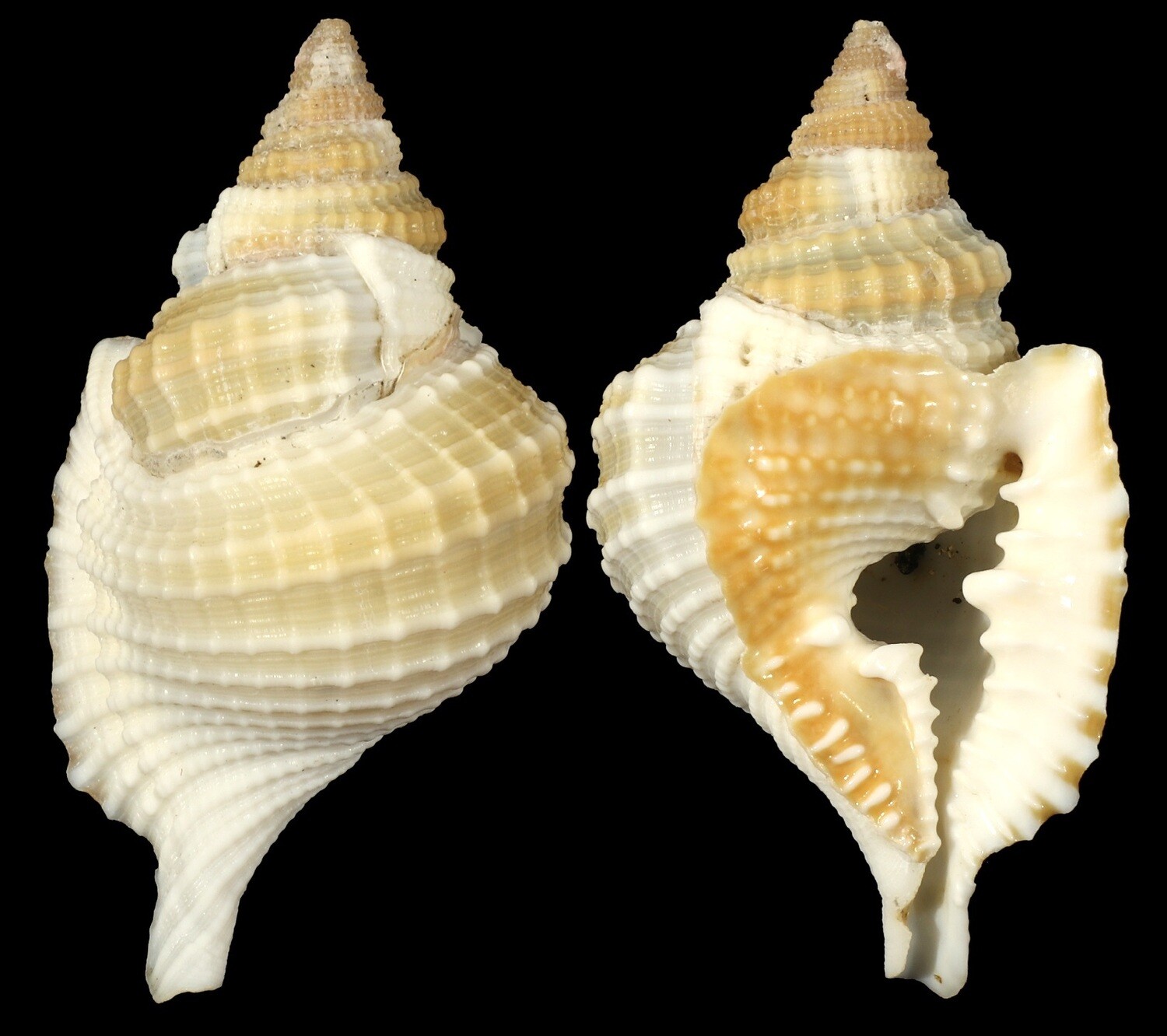 Distorsio reticularis