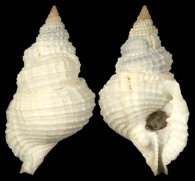 Distorsio reticularis