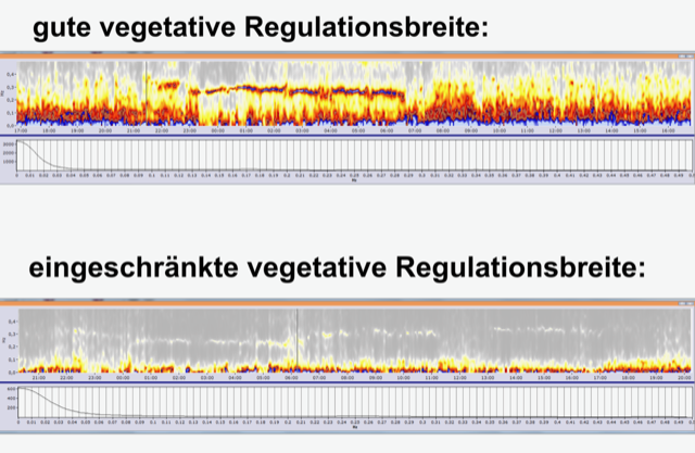 Blick ins vegetative Nervensystem / Herzratenvariabilitätsanalyse