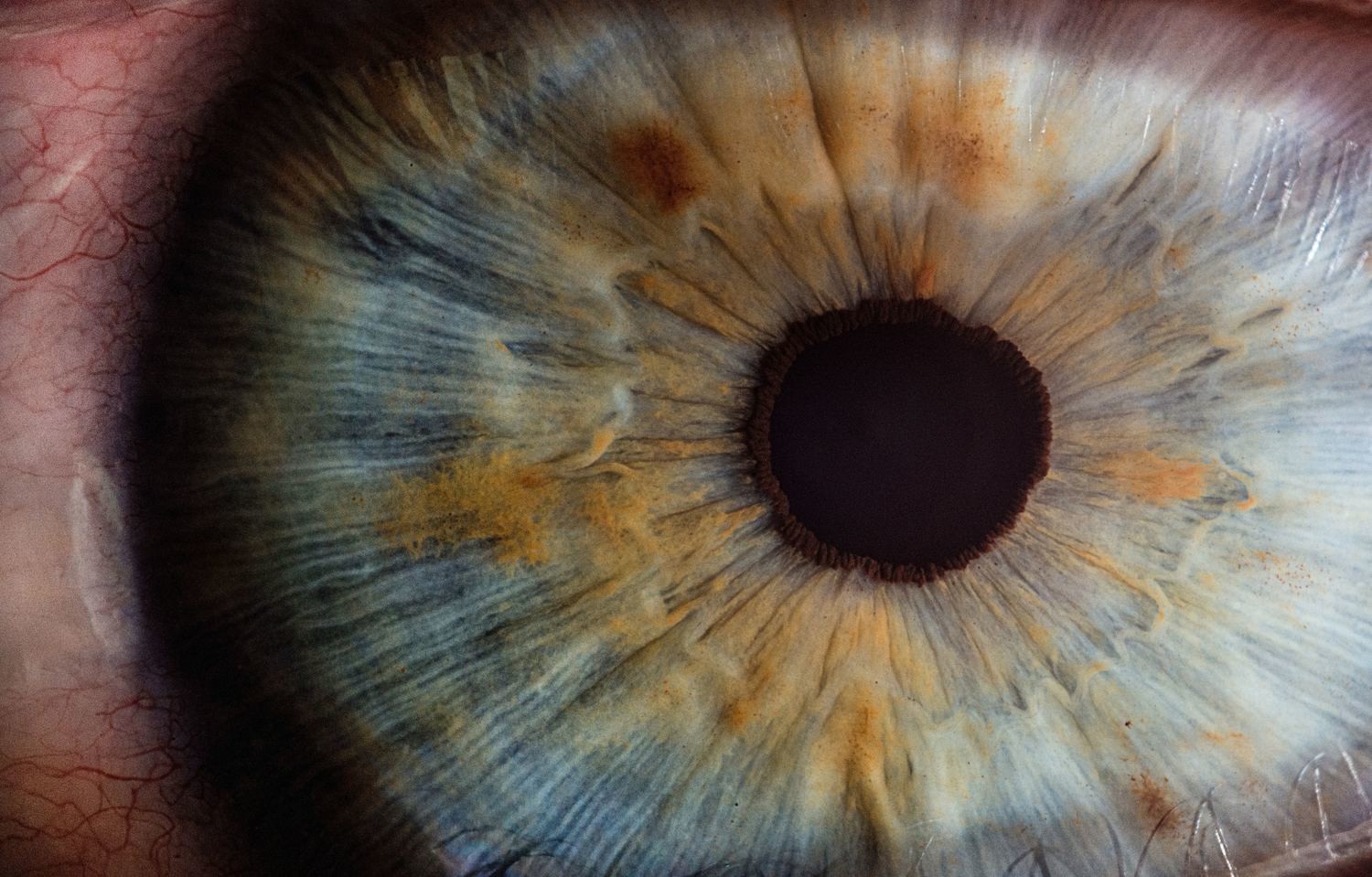The Human Eye - Diseases & Disorders - CPD