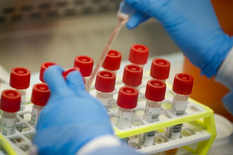 የላብራቶሪ ምርመራ Laboratory Test (Ethiopia)