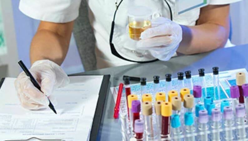 የላብራቶሪ ምርመራ Laboratory Test (Ethiopia)
