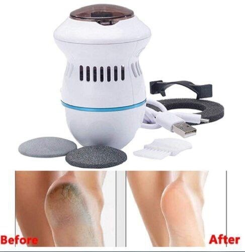 Callus Remover With Built-In Vacuum