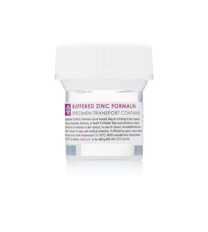 Zinc Formalin, Buffered