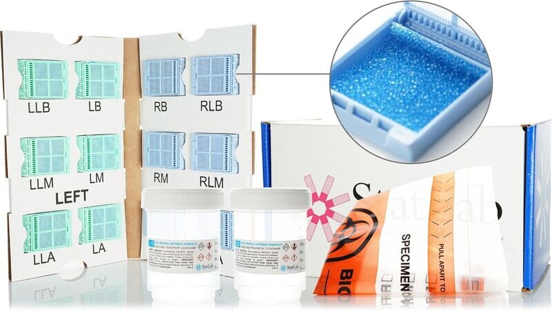 General BIOPSY KIT, 2 VIAL KIT (120ML) W/Cassettes