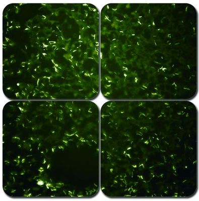 AFB Modified Truant's Fluorescent Kit, 100mL