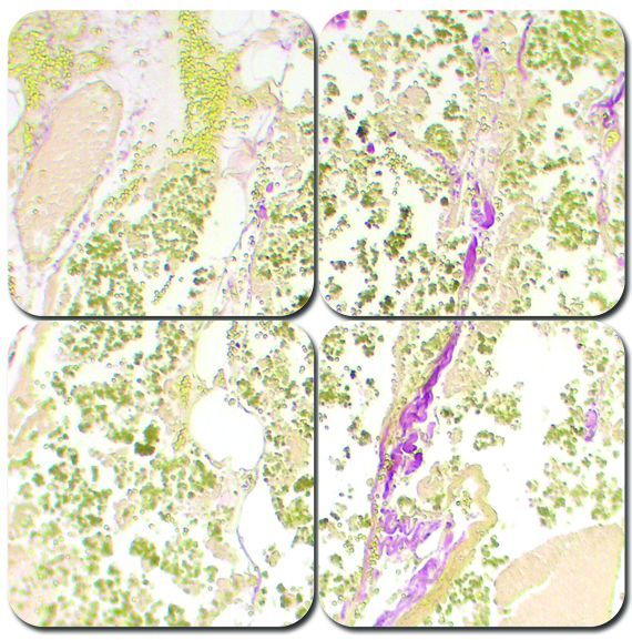Bile Stain Kit - Halls
