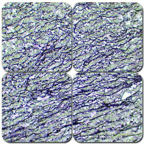 Elastic Stain Kit - Verhoeff's